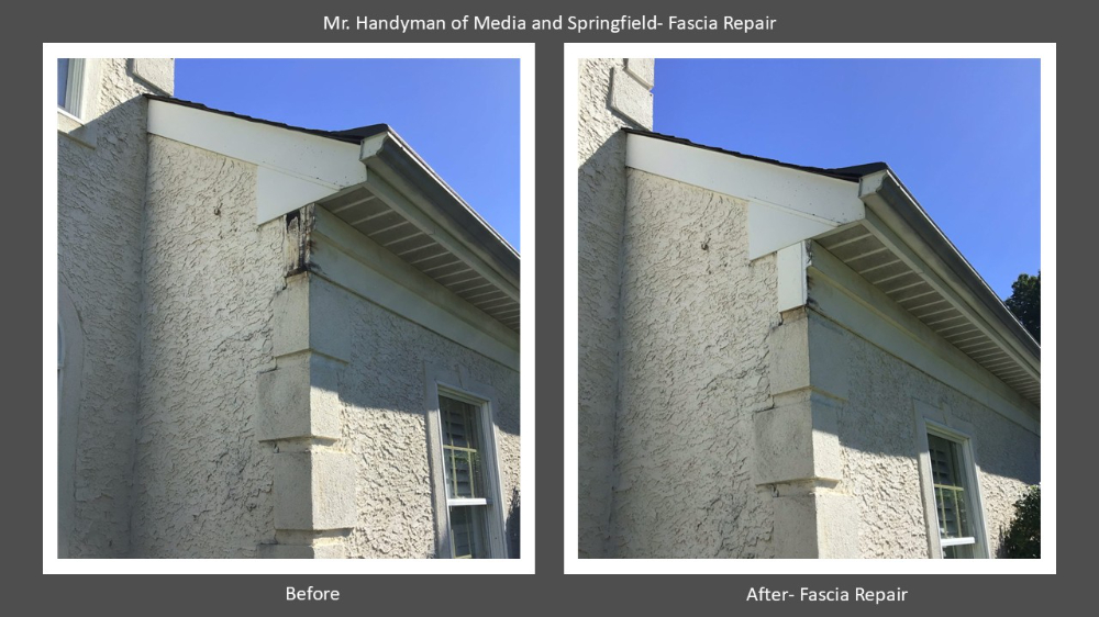 Fascia Repair- Media PA