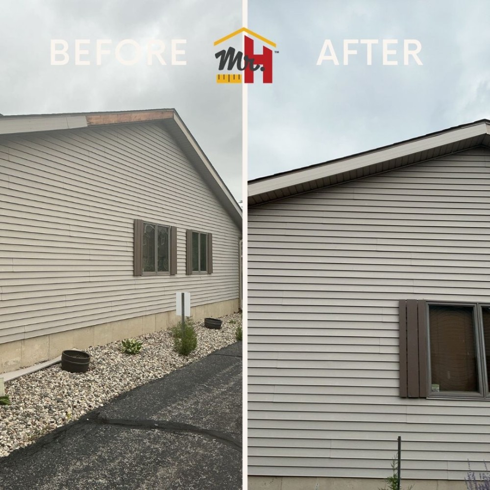 Fascia Repair