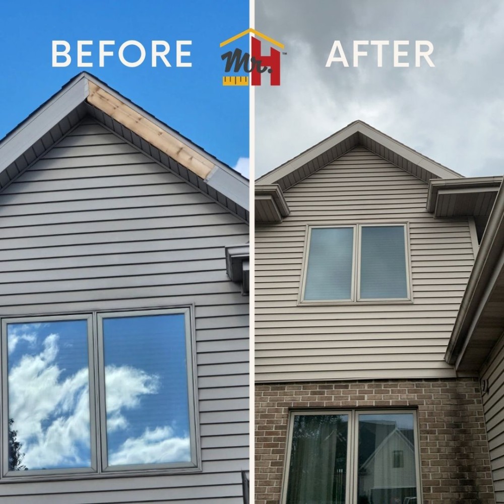 Fascia Repair